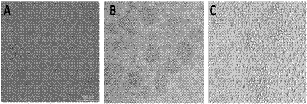 Method for enabling mononuclear cell of blood to perform reversion differentiation for producing human blood derived auto-retina stem cells as well as kit and application