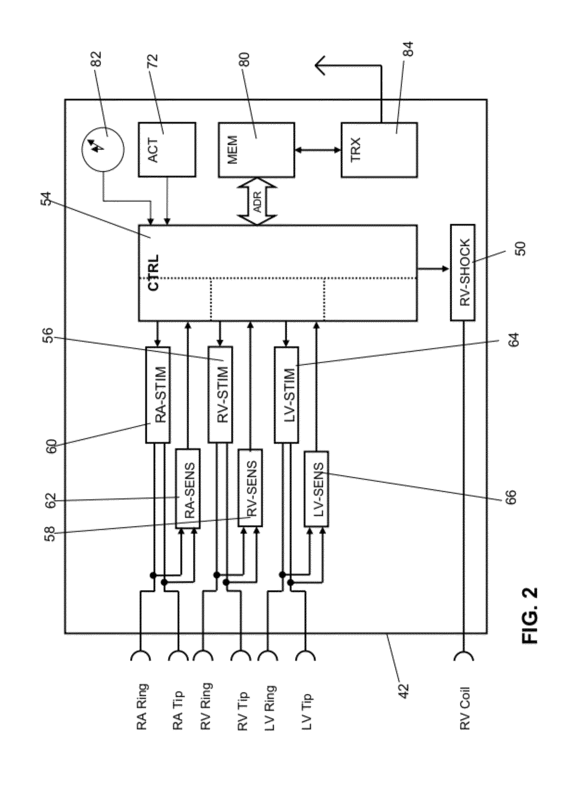 Cardiac stimulator for treatment of tachycardiac arrhythmias of the heart