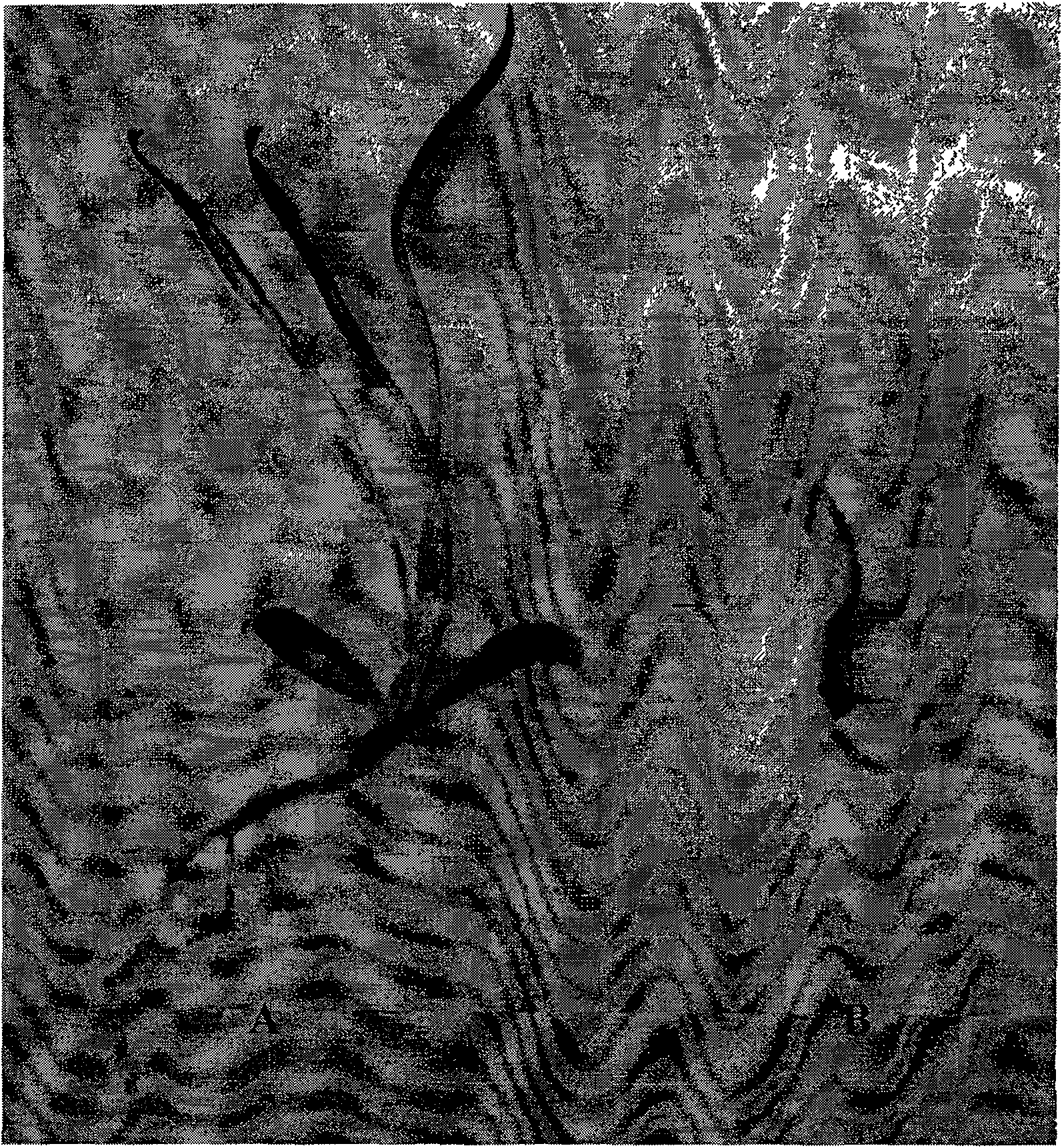 Snow lotus polyploid inducing process