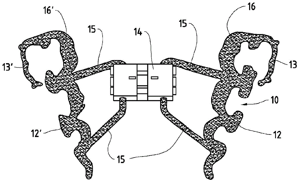 Orthodontic apparatus and method for producing an orthodontic apparatus