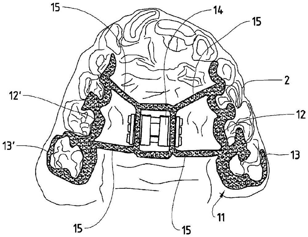 Orthodontic apparatus and method for producing an orthodontic apparatus