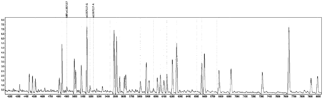 Medication guidance and gene detection kit for antihypertensive drug irbesartan