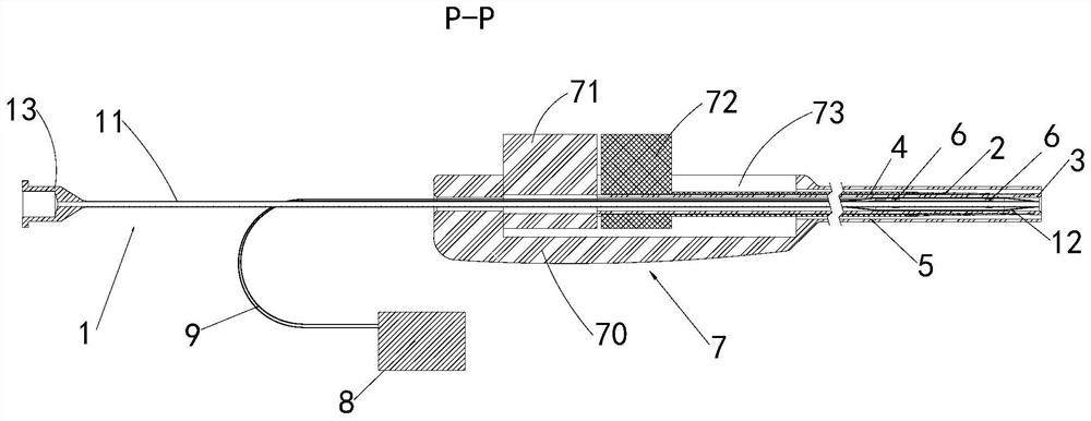 Catheter assembly capable of removing vascular obstruction plaques