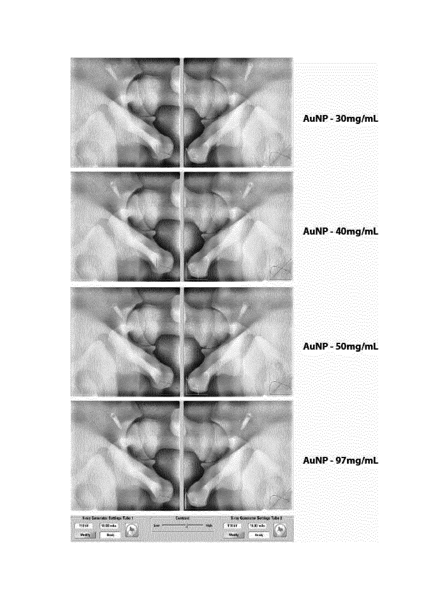 Formulation of solid nano-sized particles in a gel-forming system