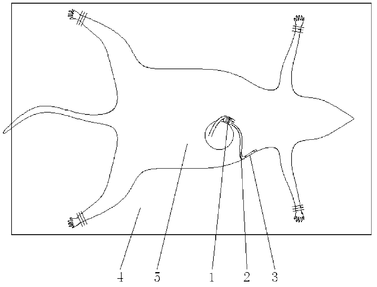 Capsule type coronary oppressing device and method for manufacturing chronic myocardial ischemia animal model