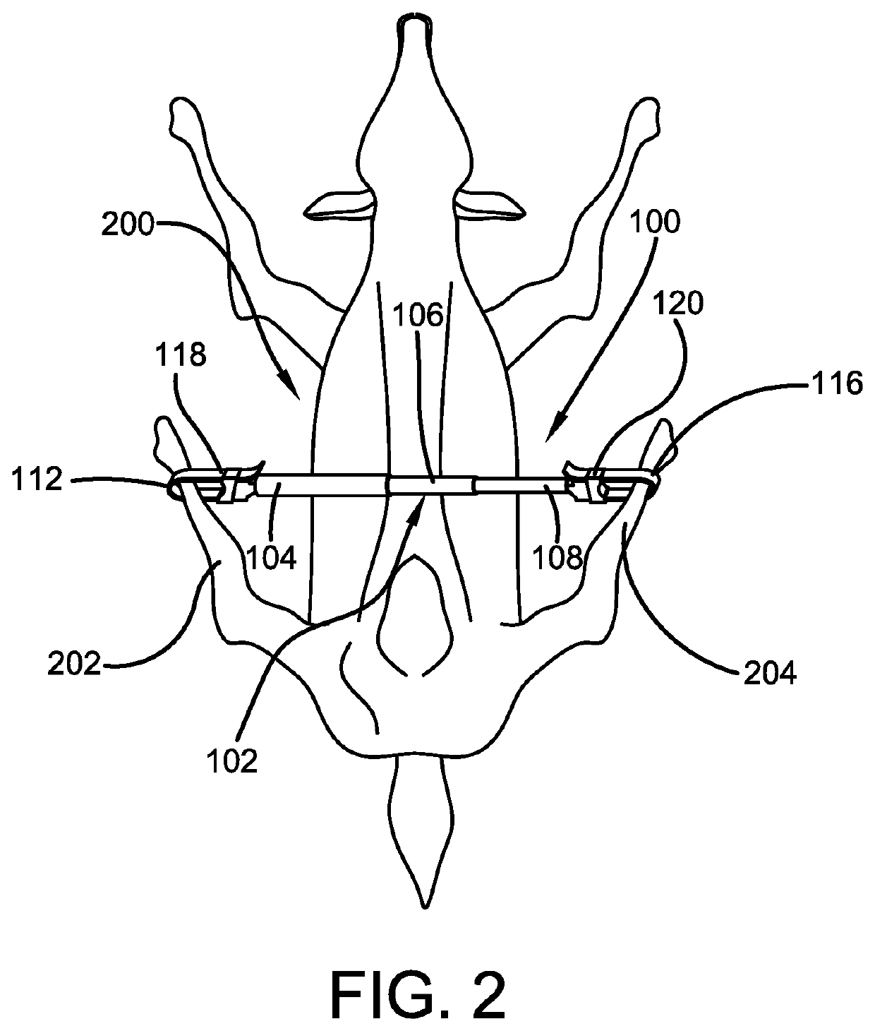 Game Animal Field Dressing Device