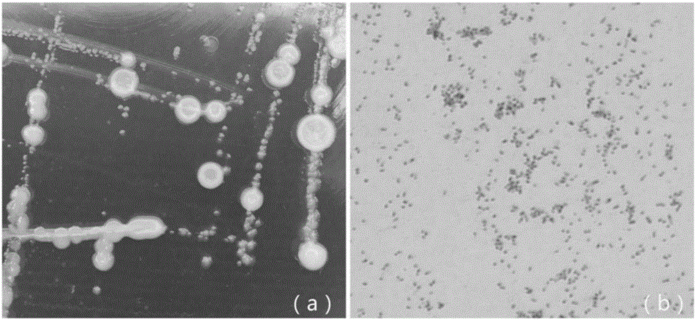 Achromobacter xylosoxidans for preventing and treating plant root-knot nematode and application of achromobacter xylosoxidans