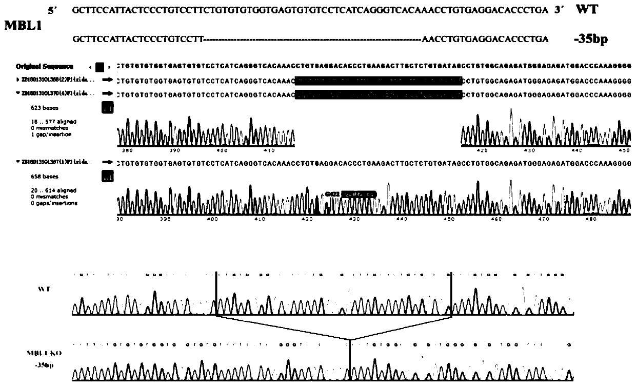 Application of MBL in preparing drug for preventing or treating obesity and method for screening drug for preventing or treating obesity