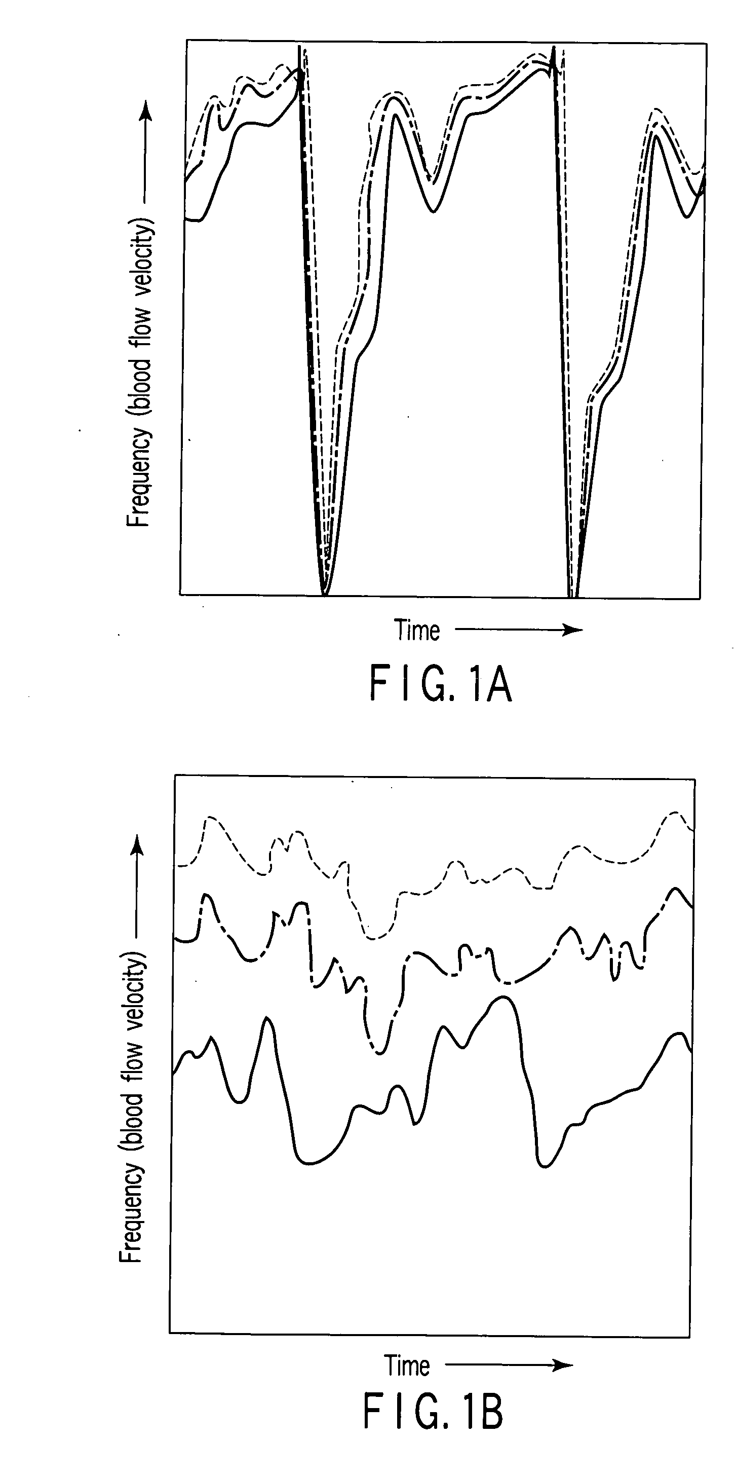 Ultrasonic doppler measuring apparatus and control method therefor