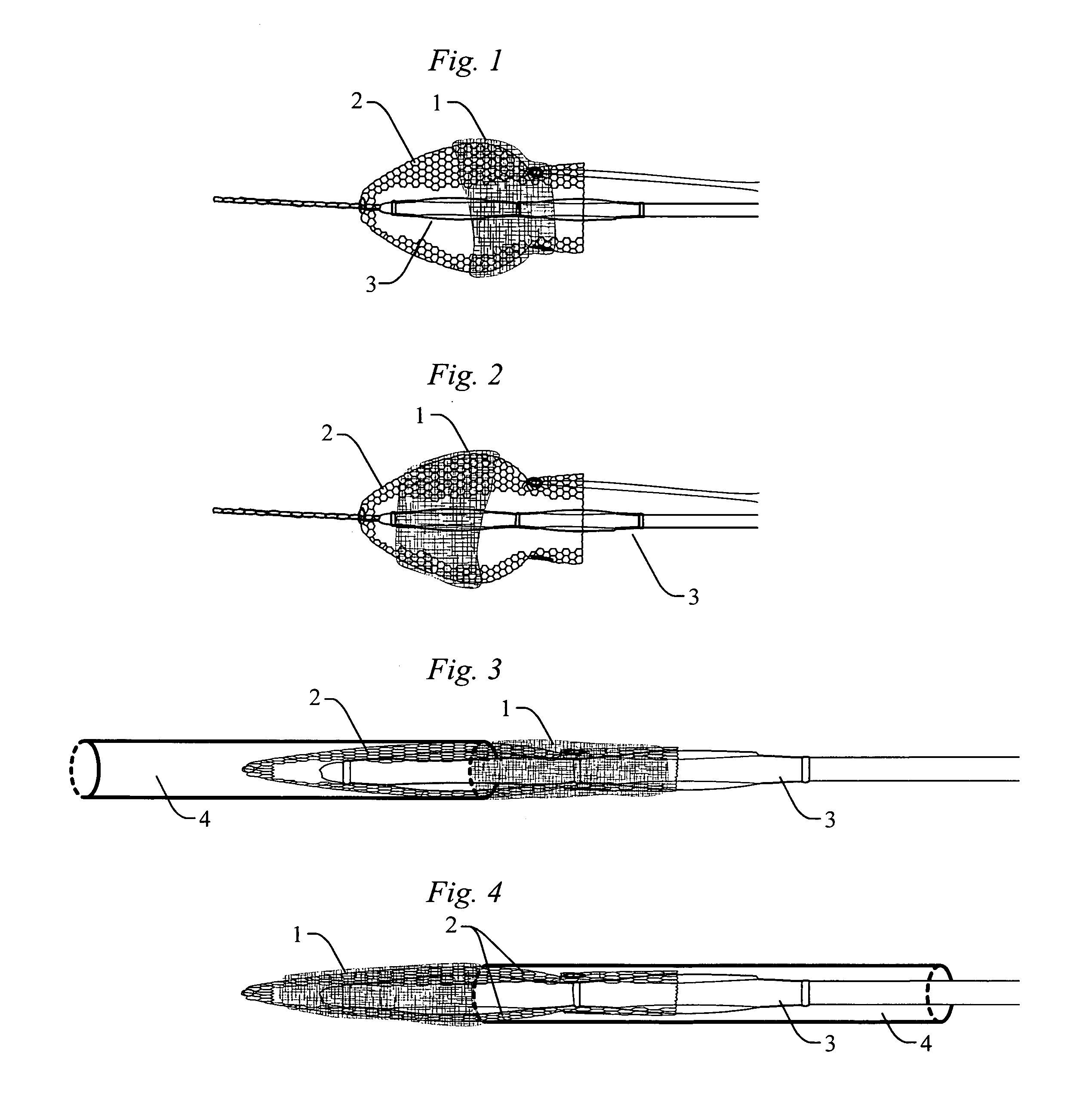 Method and apparatus for occluding a physiological opening