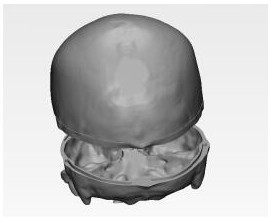 A kind of cranial brain simulation model and preparation method thereof