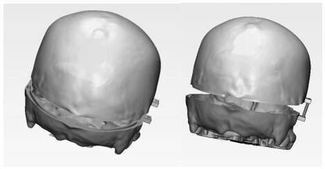 A kind of cranial brain simulation model and preparation method thereof