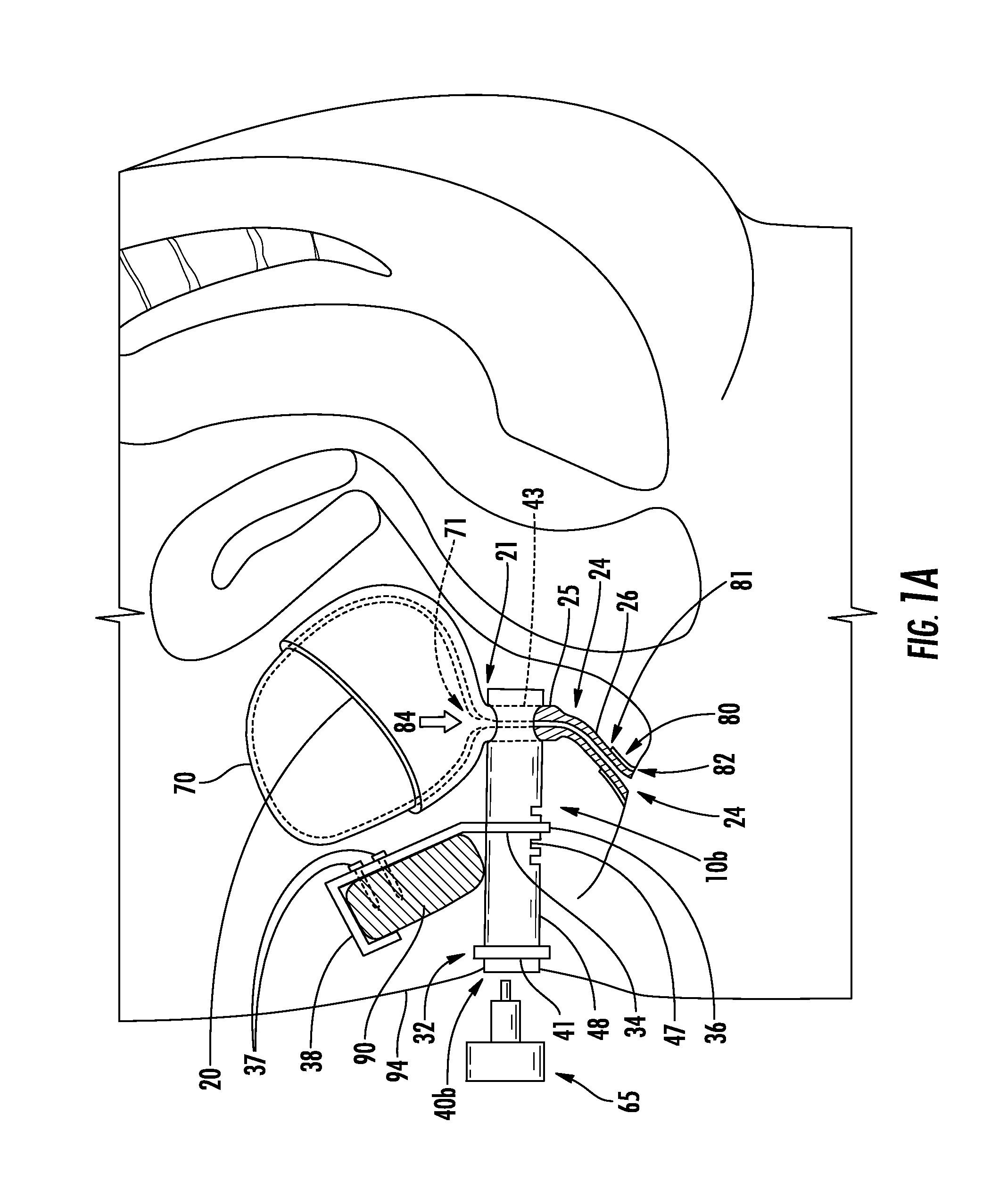 Urinary flow control device and method