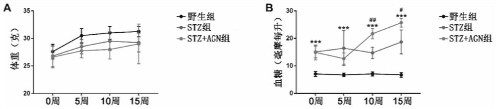 Construction method of rapid heart failure model of type 2 diabetes mellitus mouse