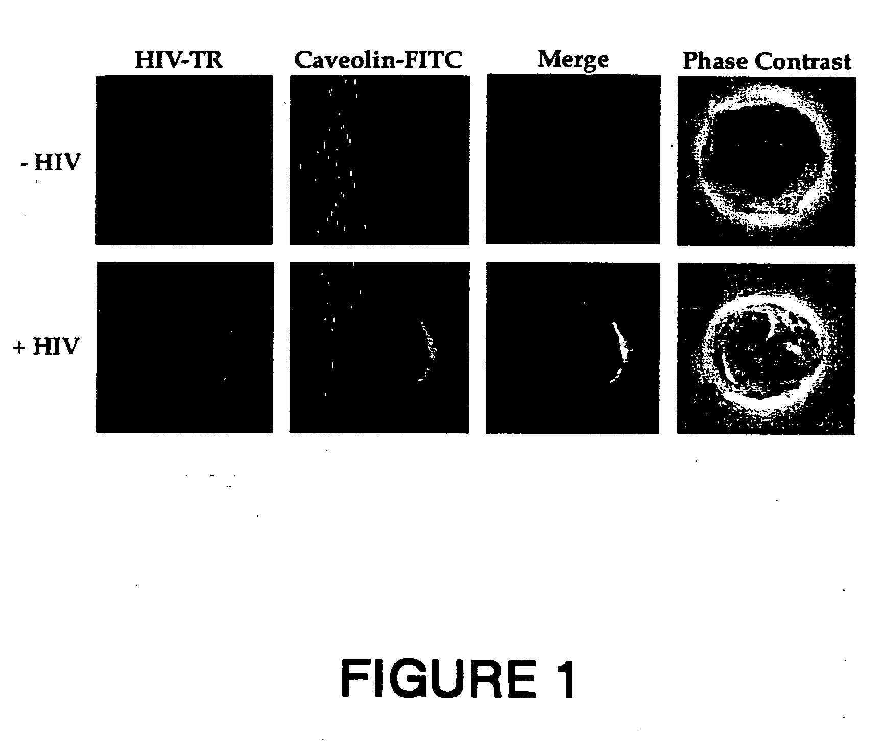 Novel synthetic peptide vaccines for HIV: the CBD epitope as an effective immunogen to elicit broadly neutralizing antibodies against HIV