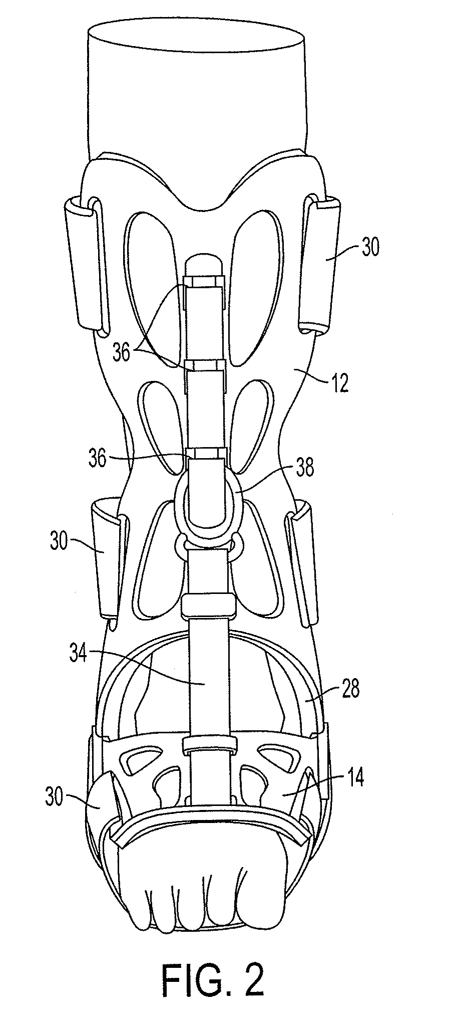 Adjustable splinting device