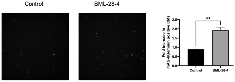 New pharmaceutical application of BML-28-4