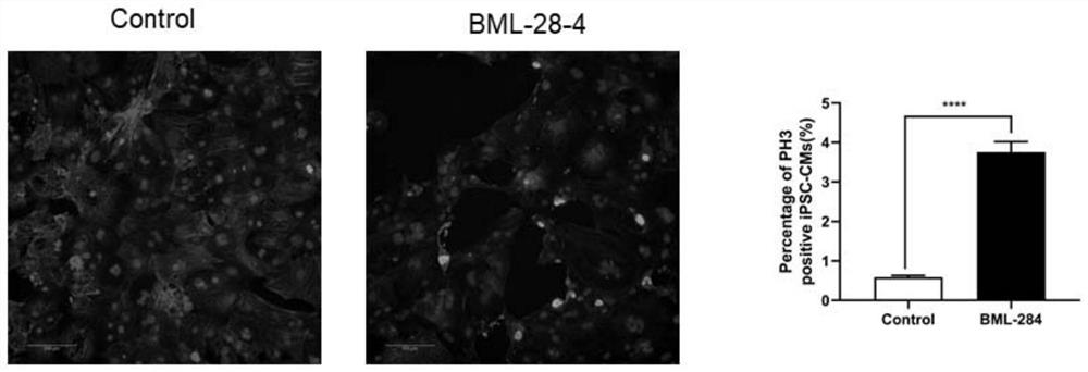 New pharmaceutical application of BML-28-4