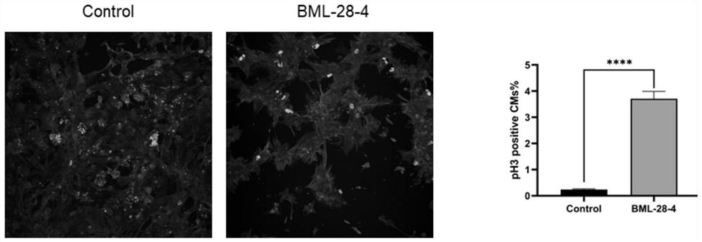 New pharmaceutical application of BML-28-4