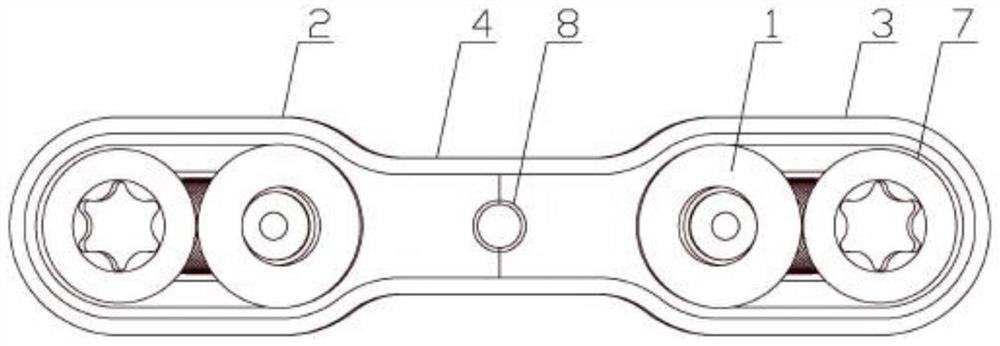 Balance locking steel plate