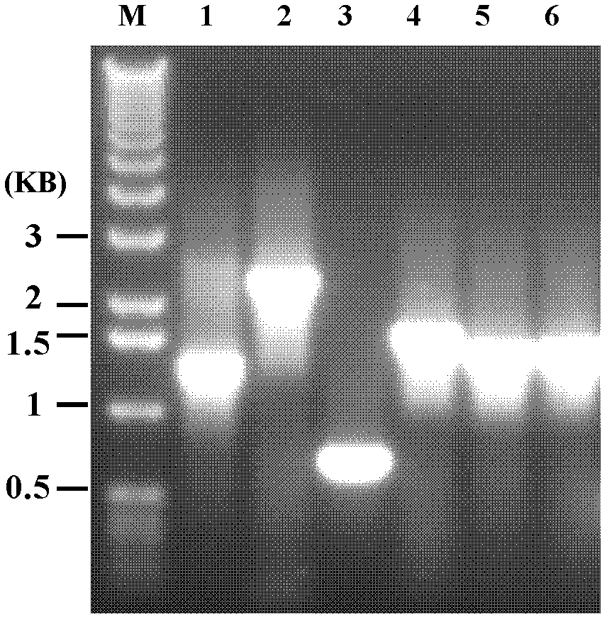 Detection kit for helicobacter pylori virulence protein antibody and detection method by using the same