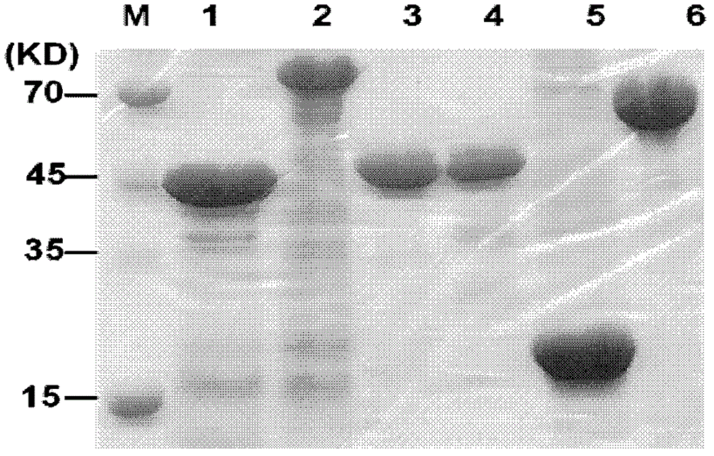 Detection kit for helicobacter pylori virulence protein antibody and detection method by using the same