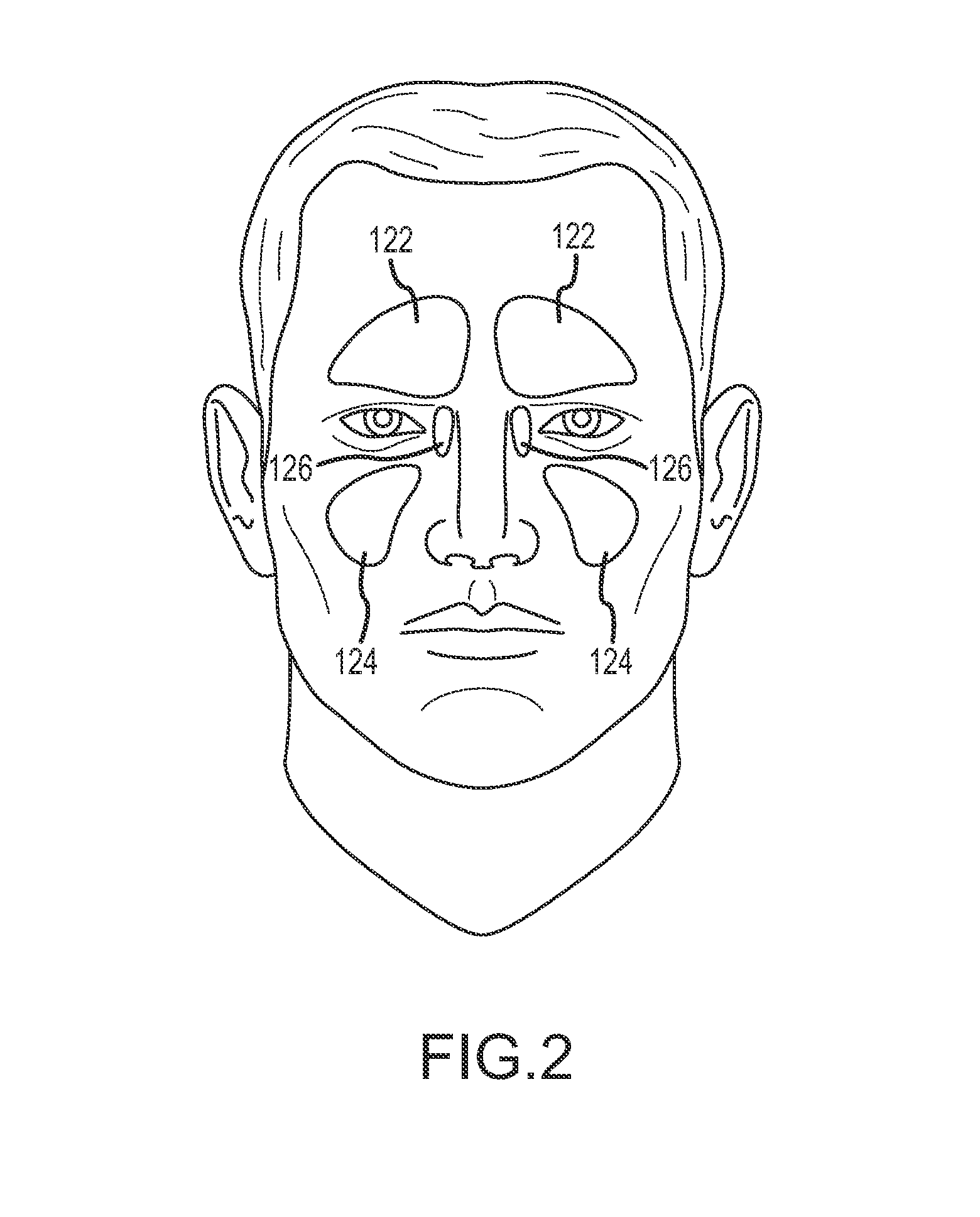 Implant device, tool, and methods relating to treatment of paranasal sinuses