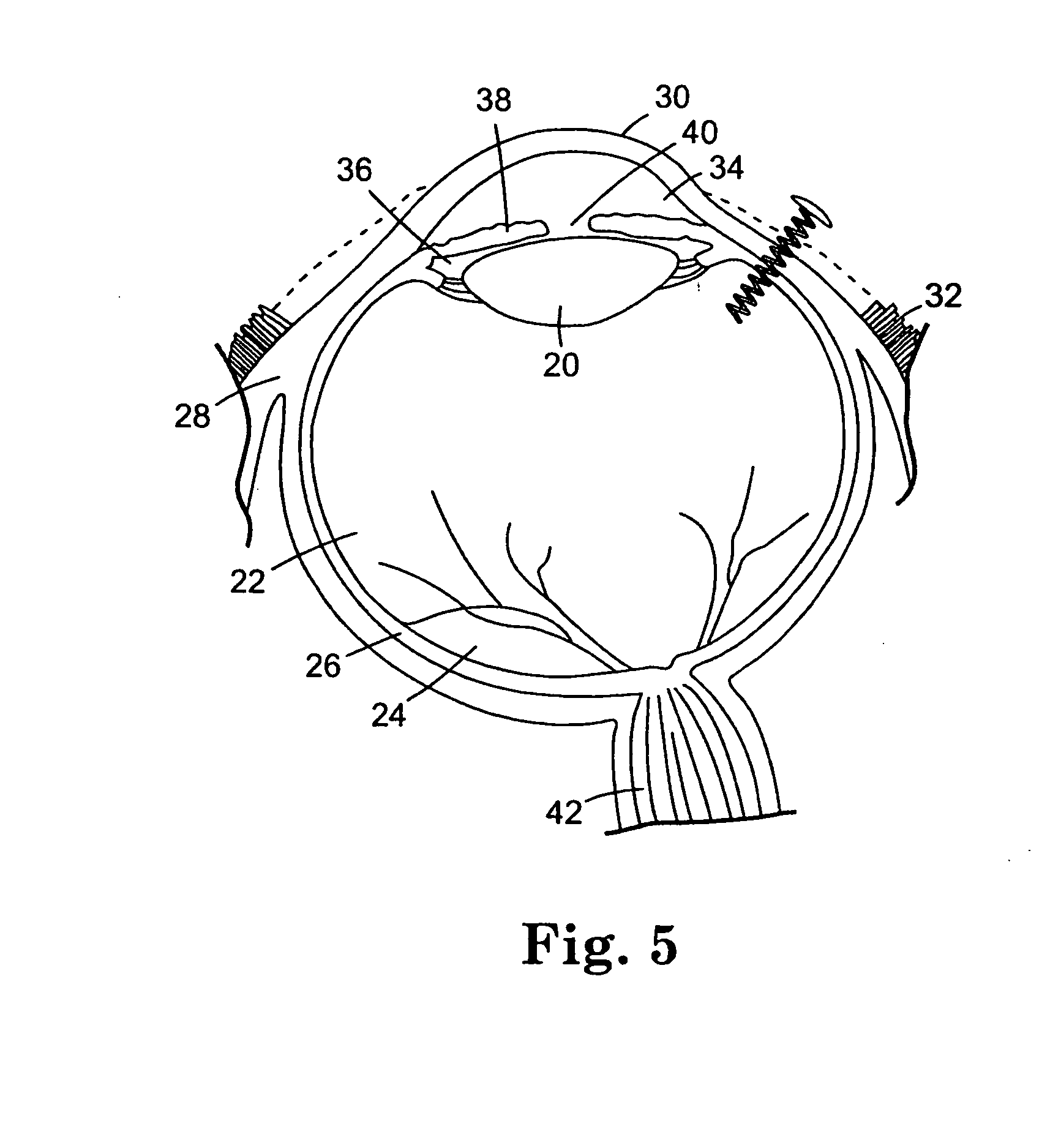 Controlled release bioactive agent delivery device