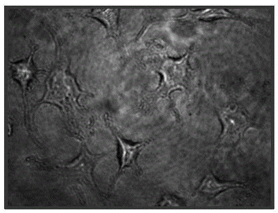 Telecentric optical structure-based transmission-type digital holographic microscopic imaging device