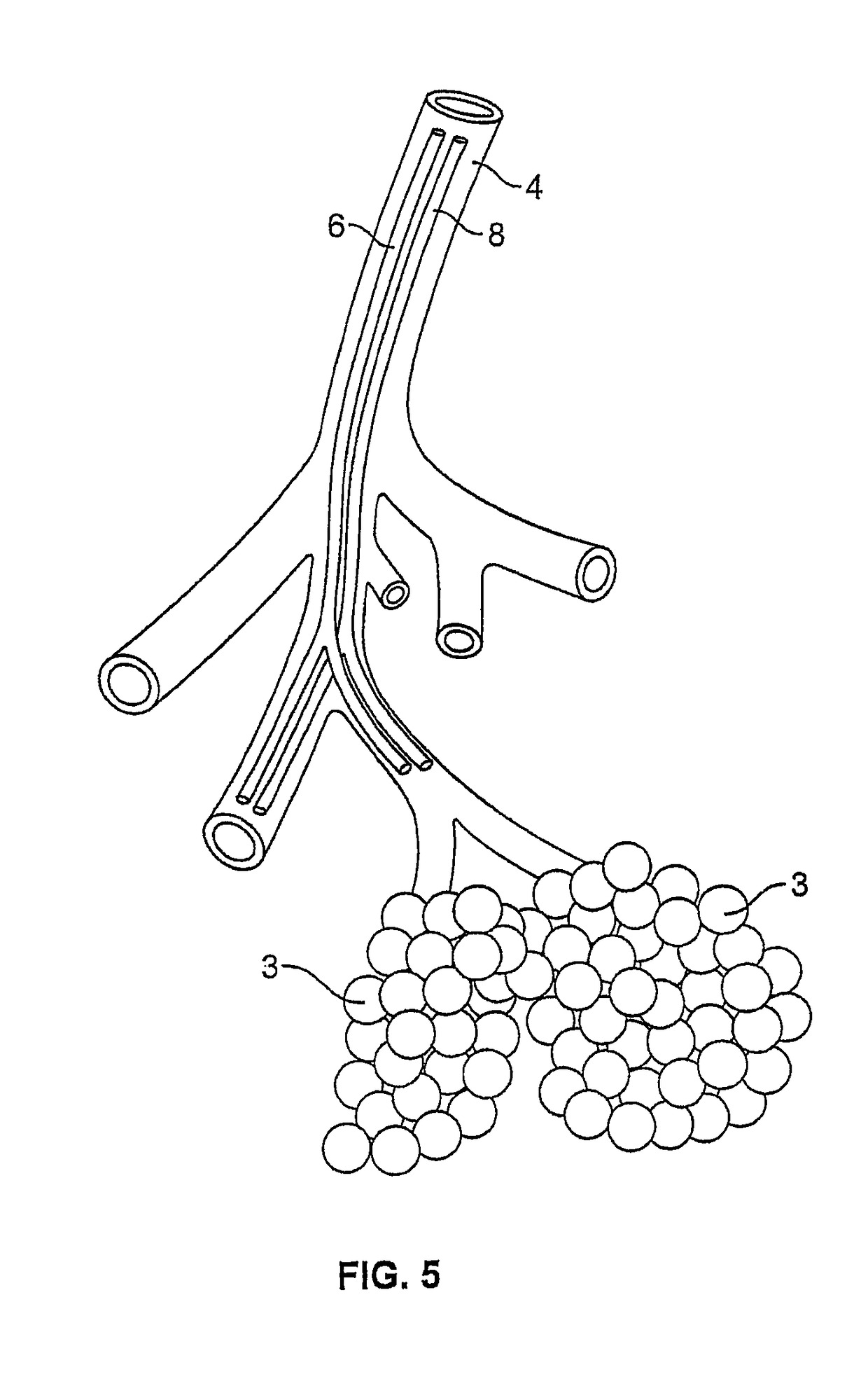 Inactivation of smooth muscle tissue