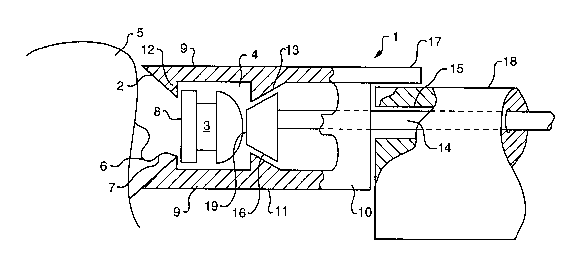 Suture clips, delivery devices and methods