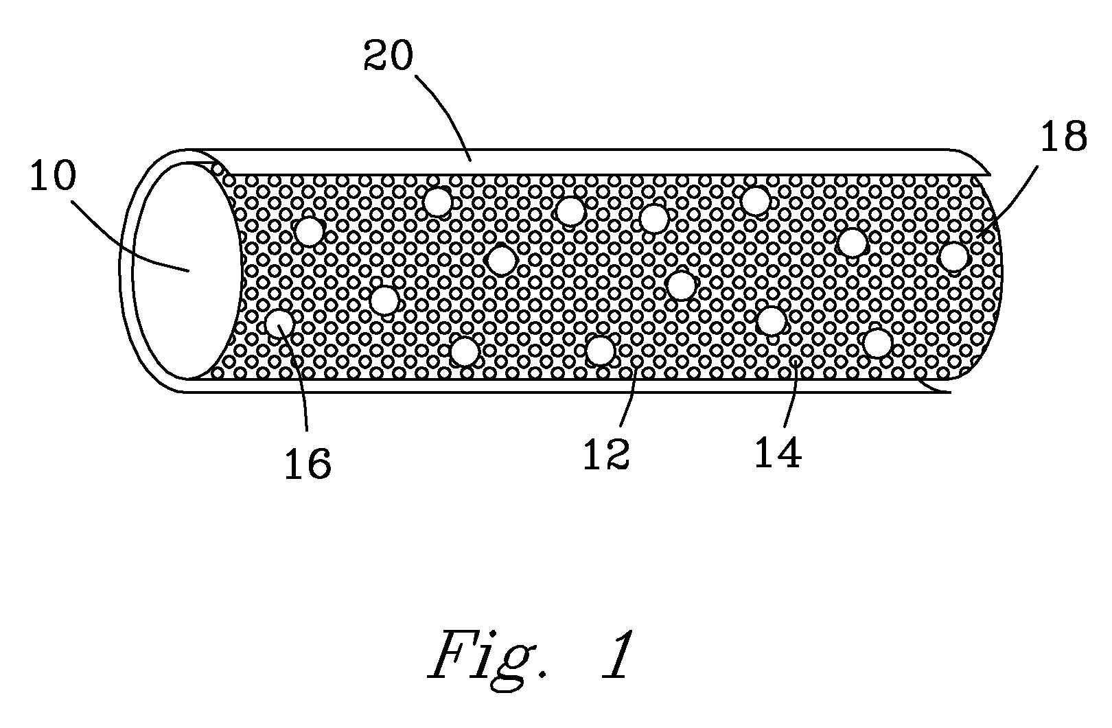 Brachytherapy Seed With Fast Dissolving Matrix for Optimal Delivery of Radionuclides To Cancer Tissue