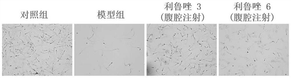 Application of riluzole in treatment of oligospermia