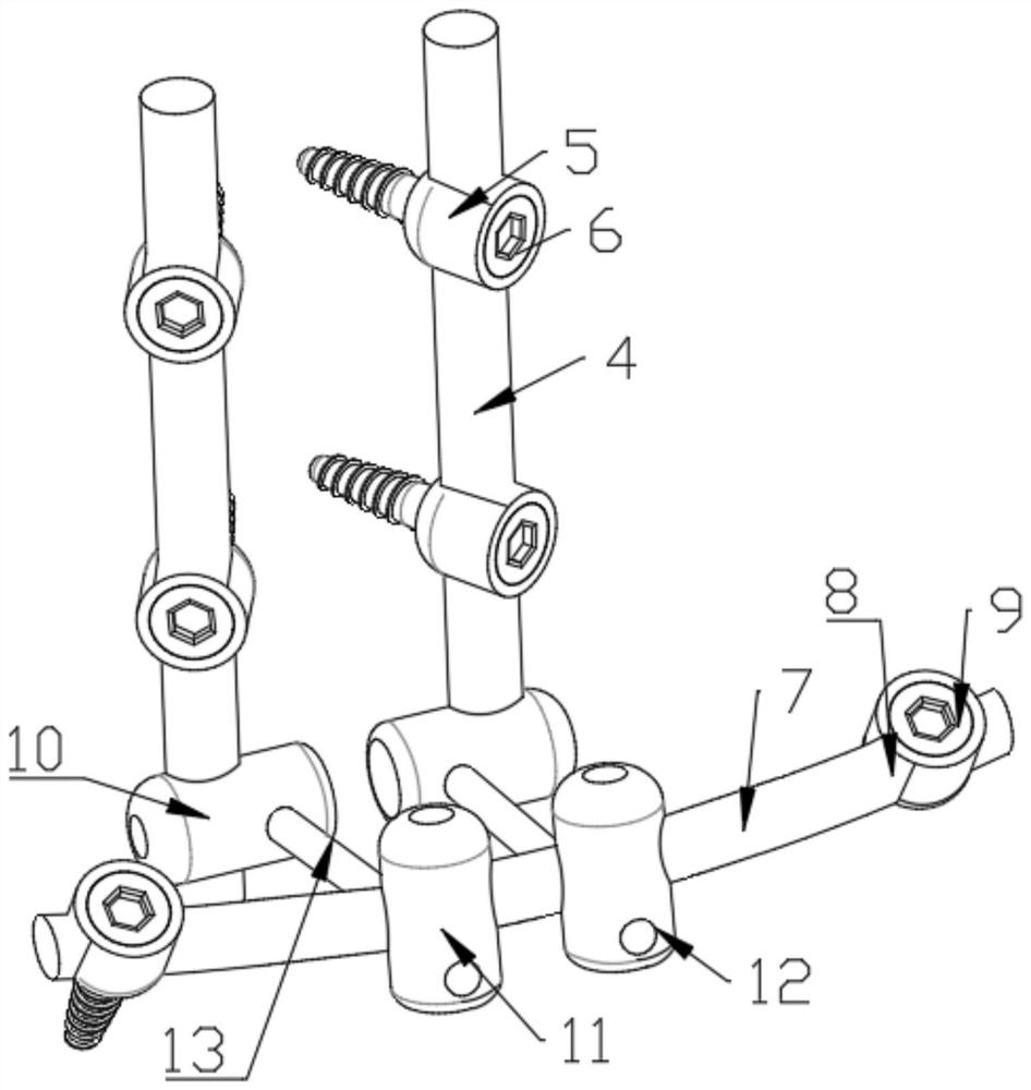 Multi-dimensional internal fixation device and method for treating pelvic posterior ring fracture dislocation