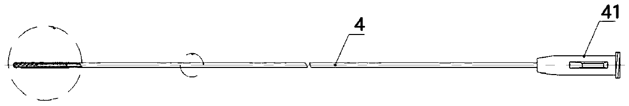 Device (skeleton) for percutaneous trigeminal nerve meniscus balloon compression