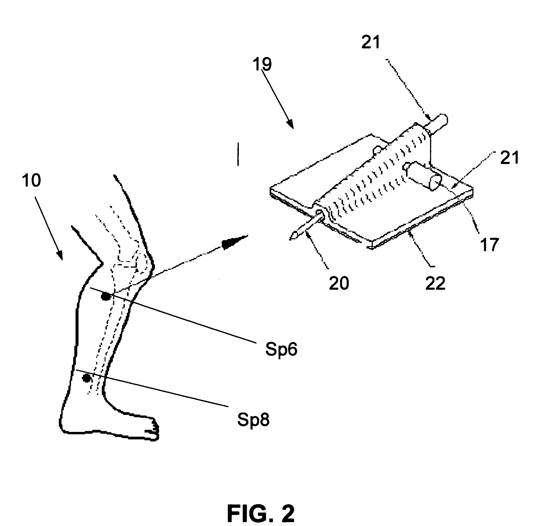 Method of pain relief in patients after abdominal/pelvic surgery