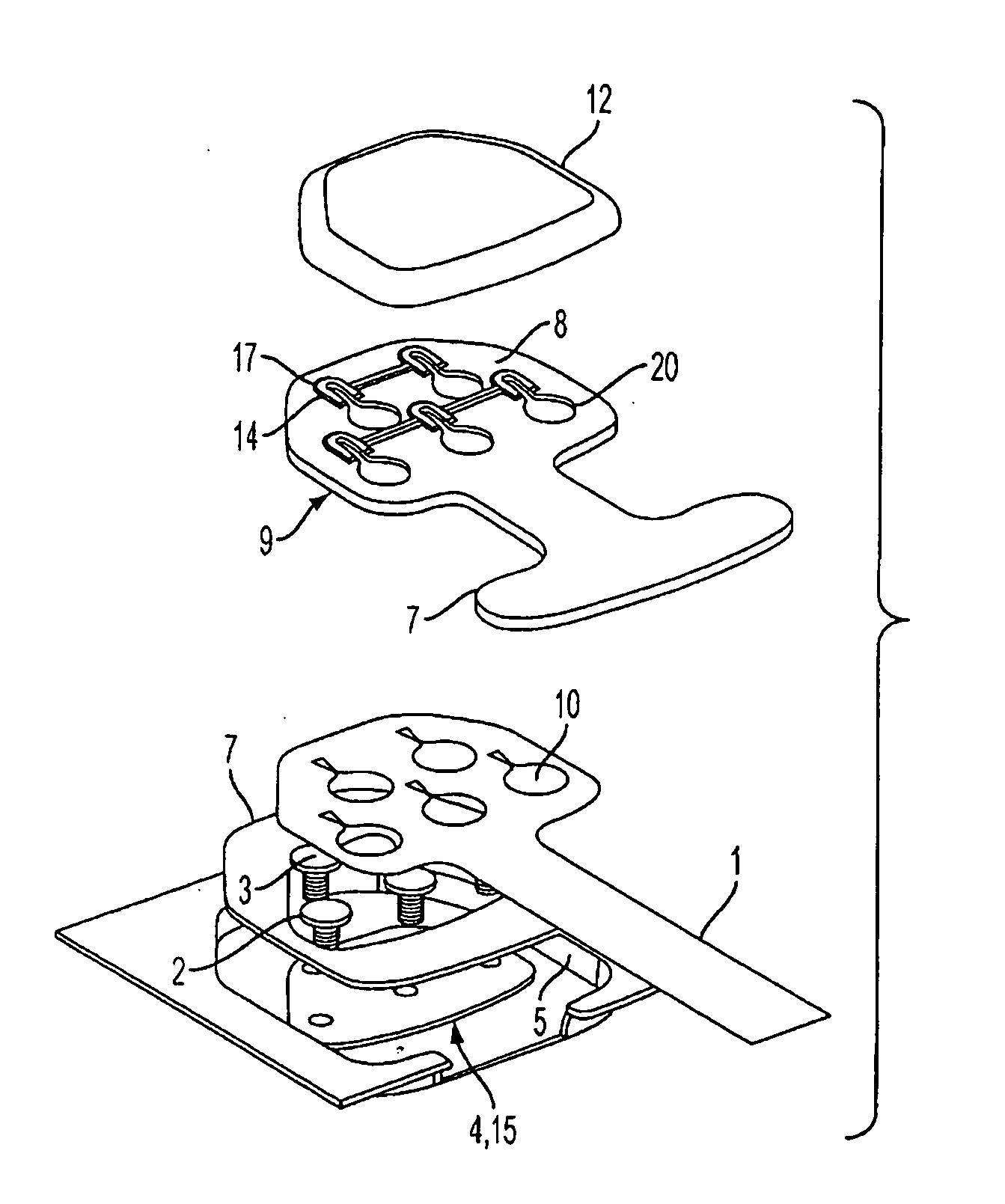 Multi-lead keyhole connector