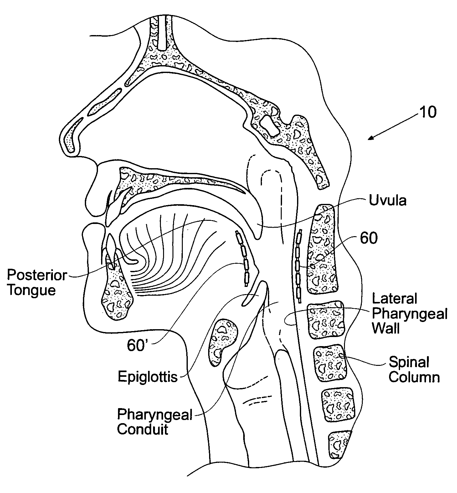 Magnetic force devices, systems, and methods for resisting tissue collapse within the pharyngeal conduit