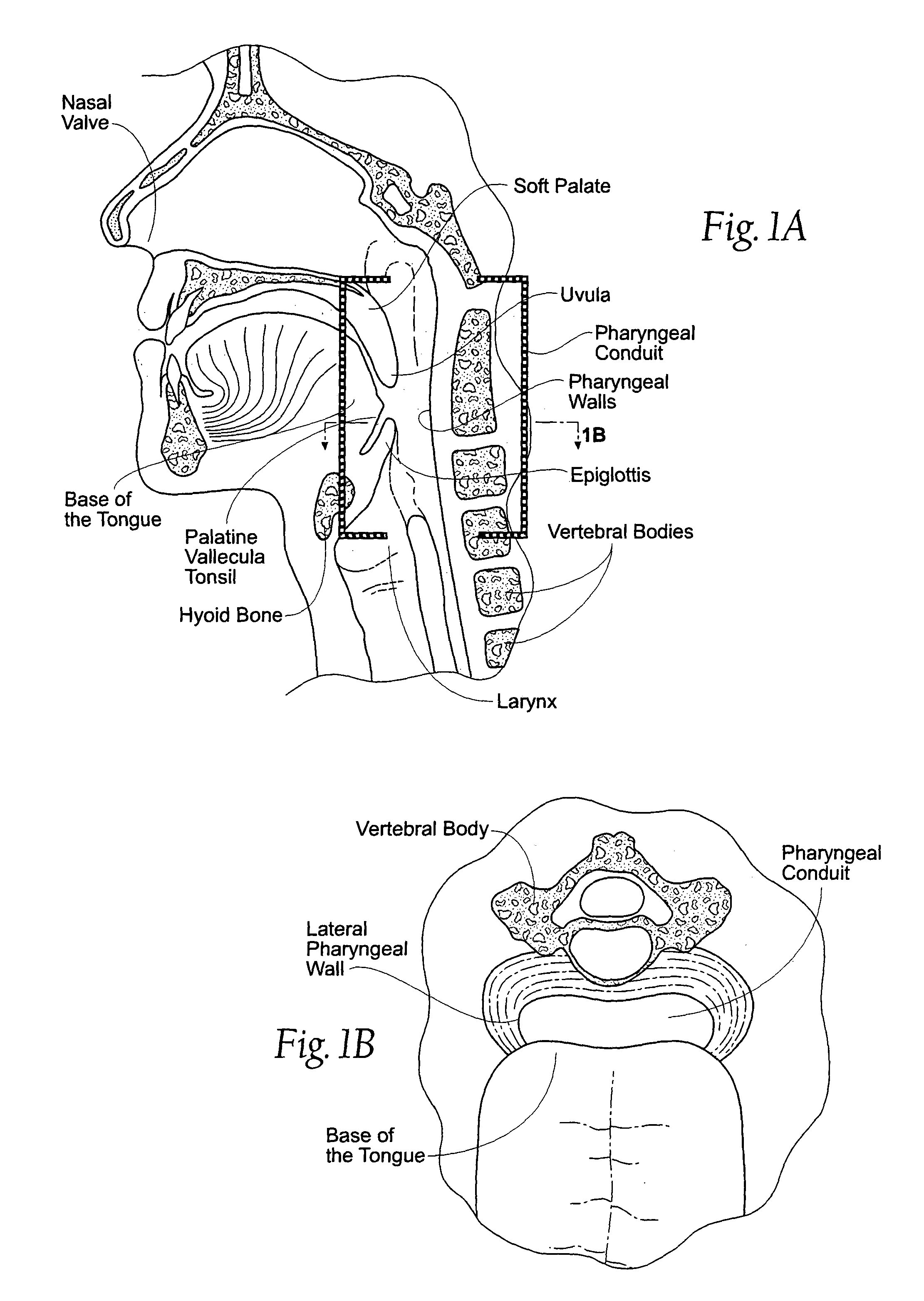 Magnetic force devices, systems, and methods for resisting tissue collapse within the pharyngeal conduit