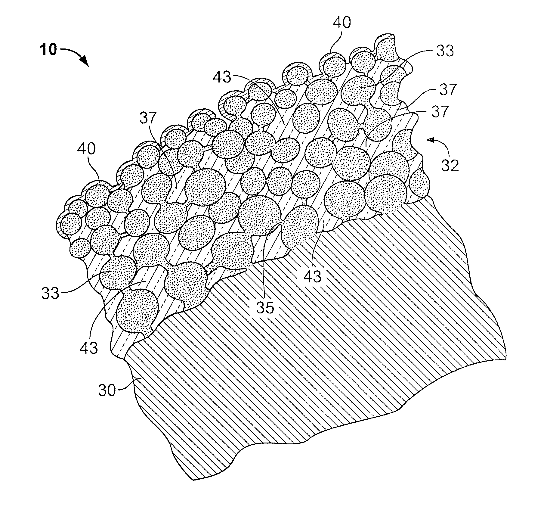 Drug-releasing stent with ceramic-containing layer