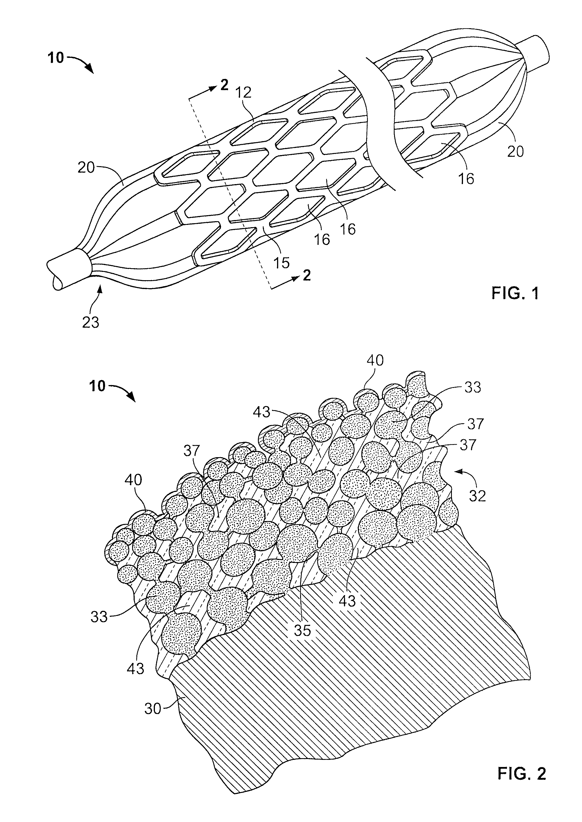 Drug-releasing stent with ceramic-containing layer