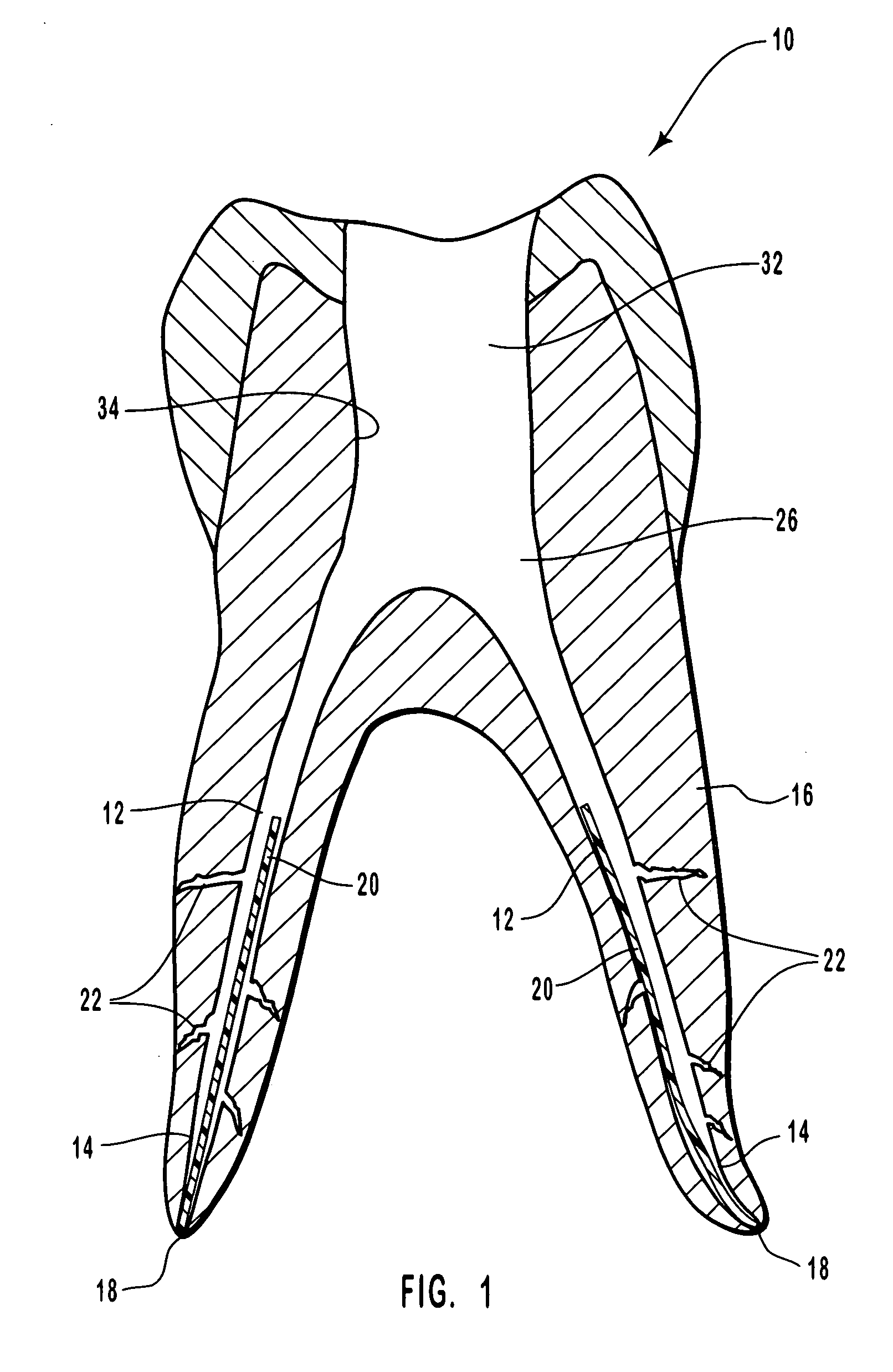 Hydrophilic endodontic sealing compositions and methods for using such compositions