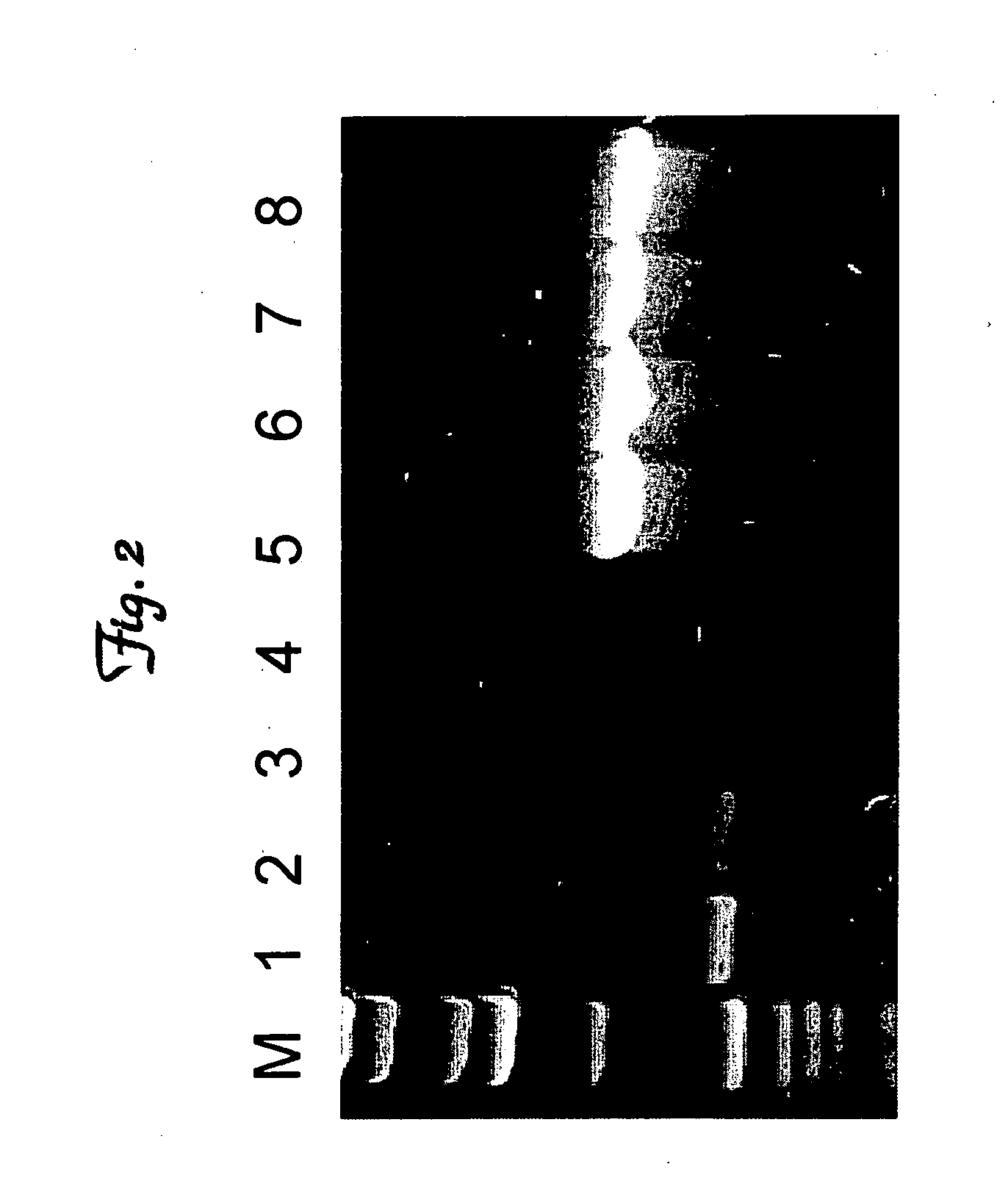 Use of umbilical cord blood stem cells to treat ischemic event