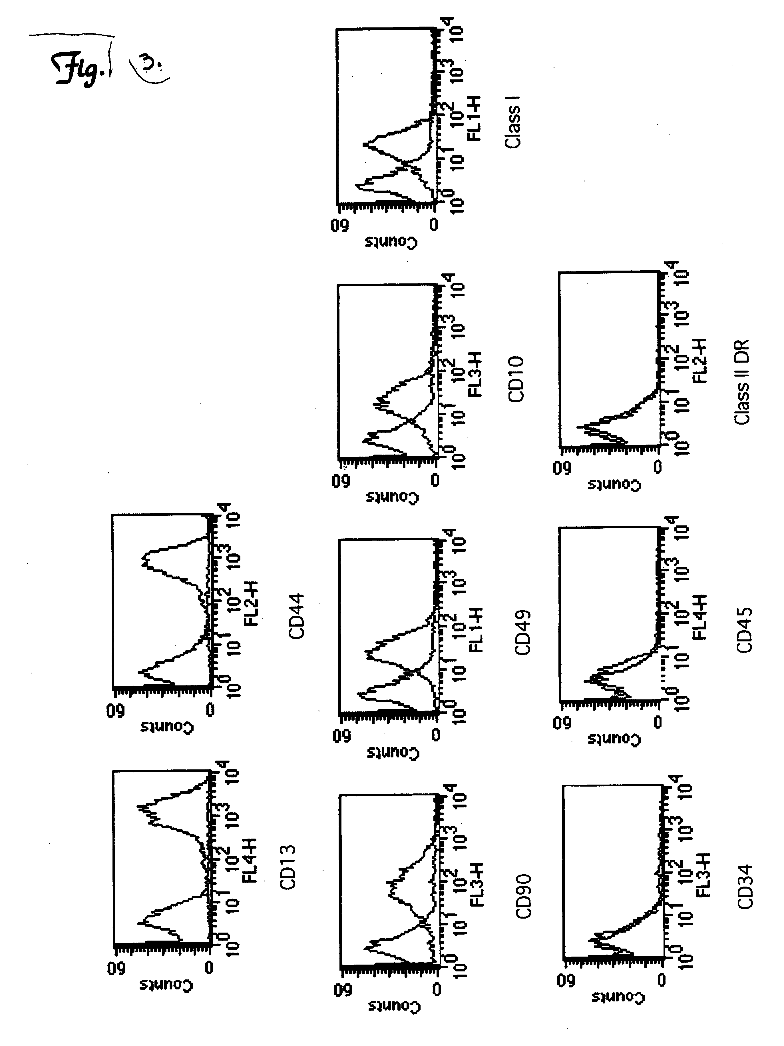 Use of umbilical cord blood stem cells to treat ischemic event