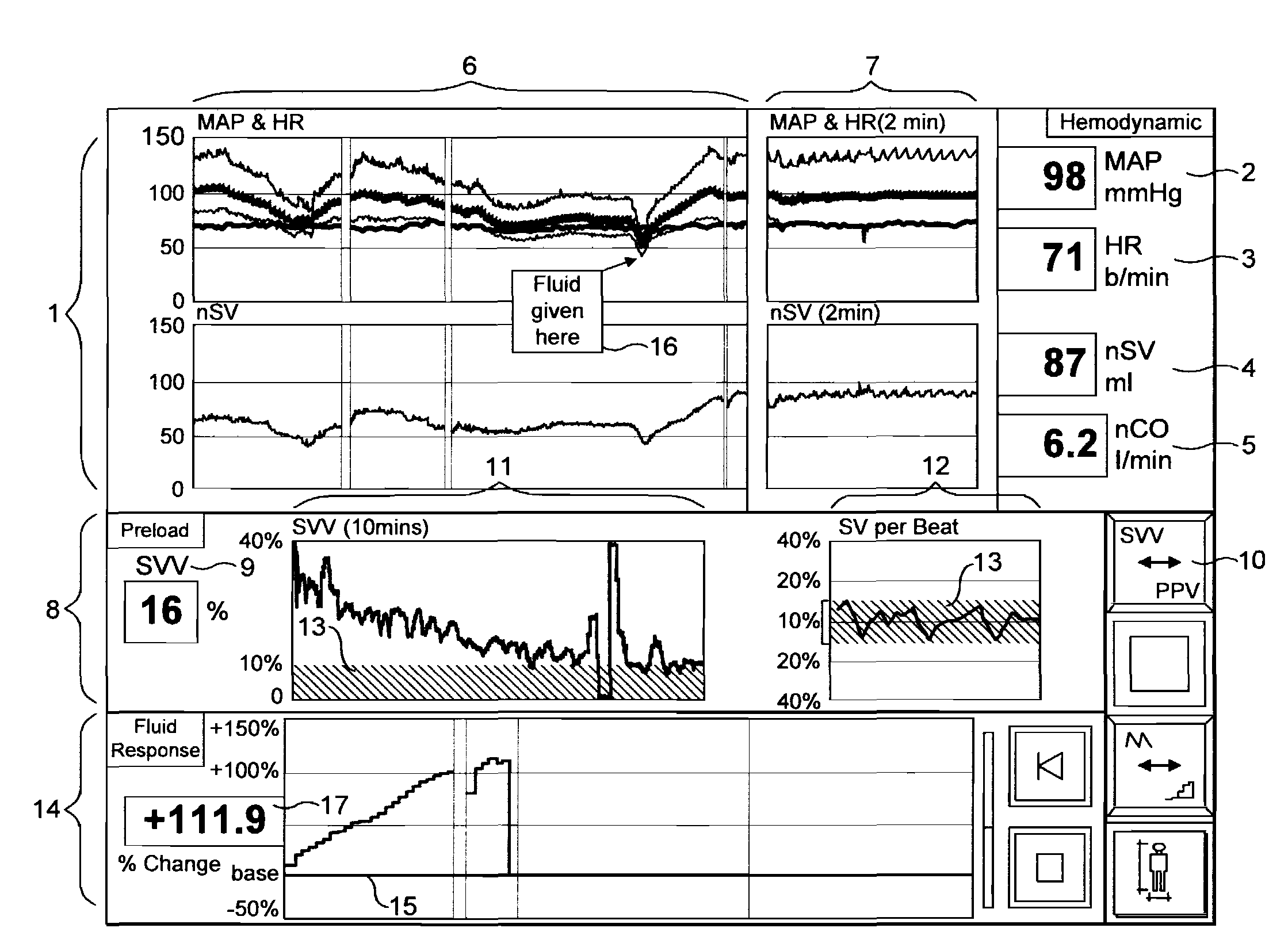 Patient Monitoring