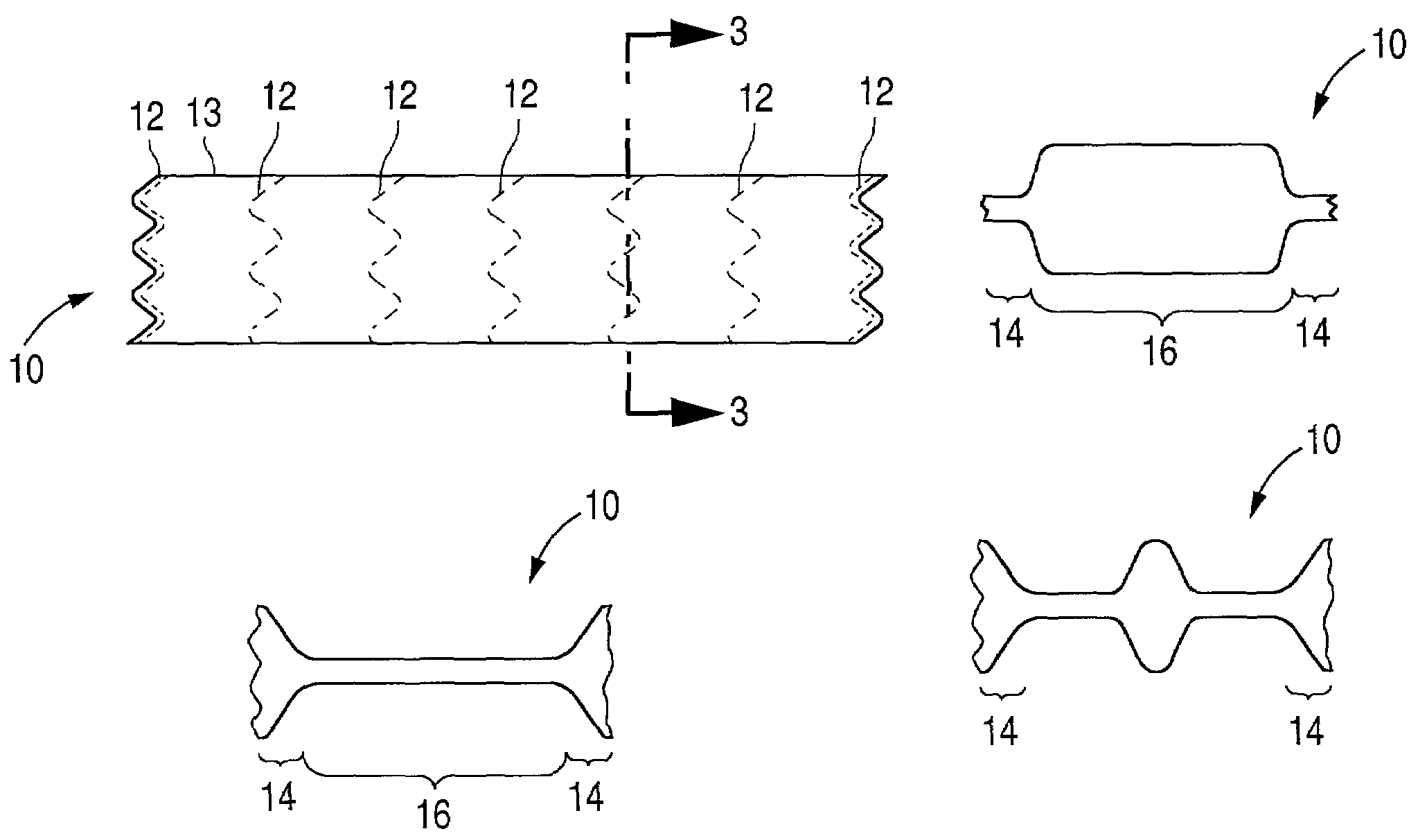 Flexible stent and method of making the same