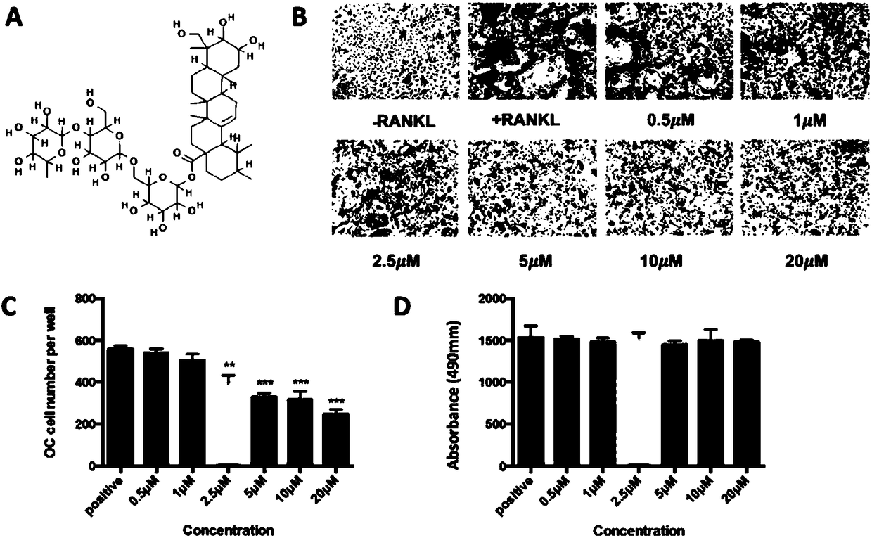 Application of asiaticoside in treating bone metabolic abnormality