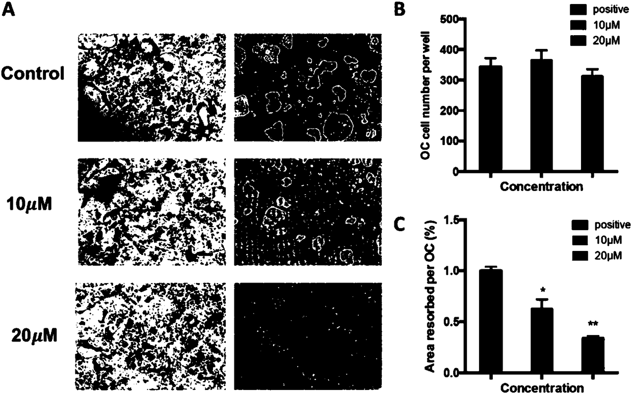 Application of asiaticoside in treating bone metabolic abnormality