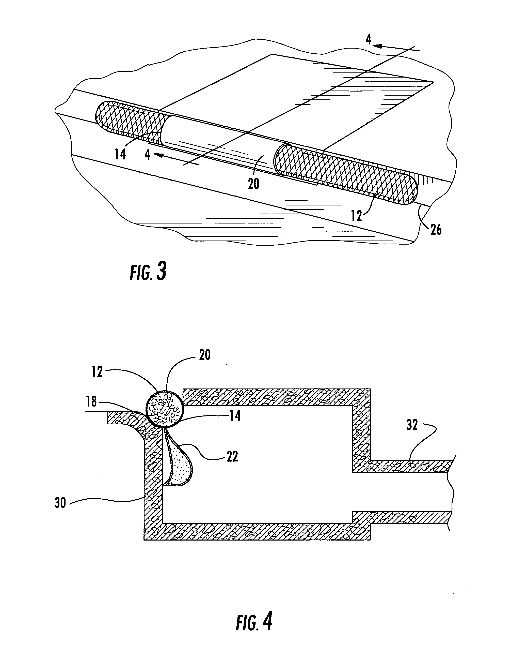 System for filtering stormwater-carried debris flowing through a gutter inlet into a catch basin