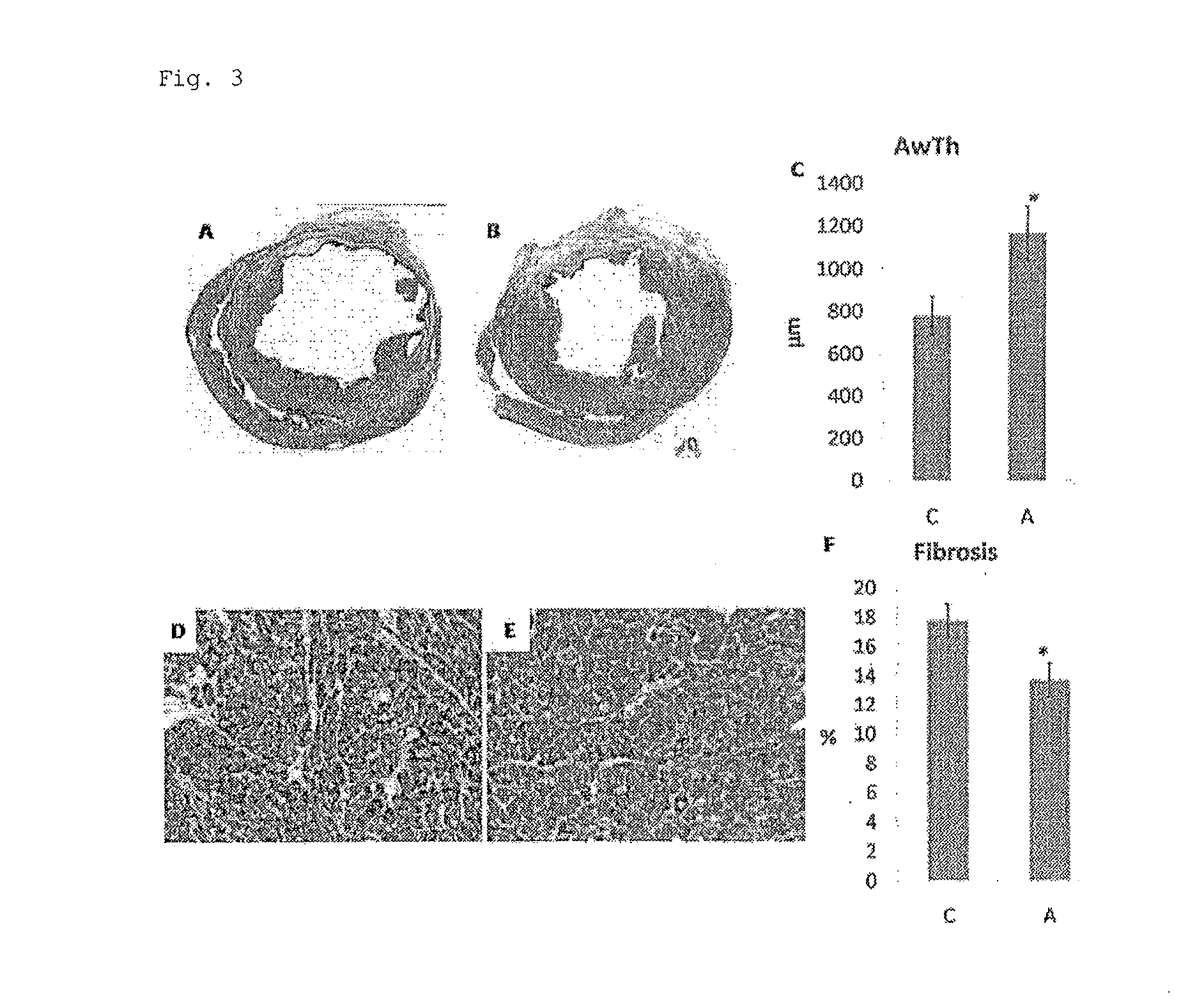 Adipocyte sheet, three-dimensional structure thereof, and method for producing the same